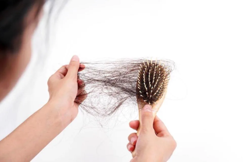 Tóc rụng nhiều là bị gì